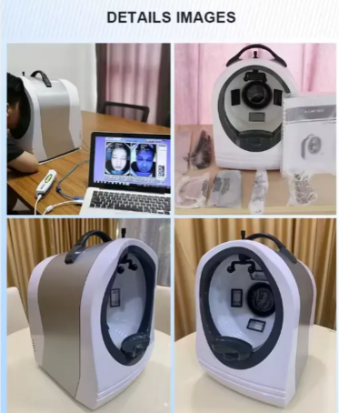 Analizador De Piel Inteligente IA Beco Scanner Facial 3D - Imagen 5