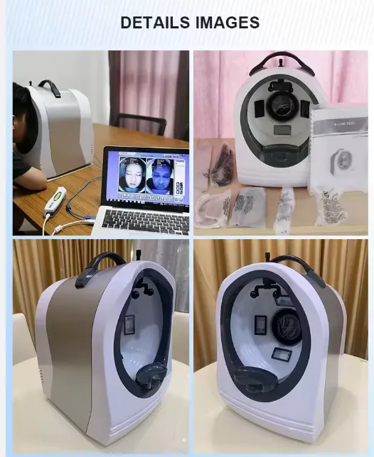 Analizador De Piel Inteligente Ia Beco 3d Scanner Facial IA - Imagen 3